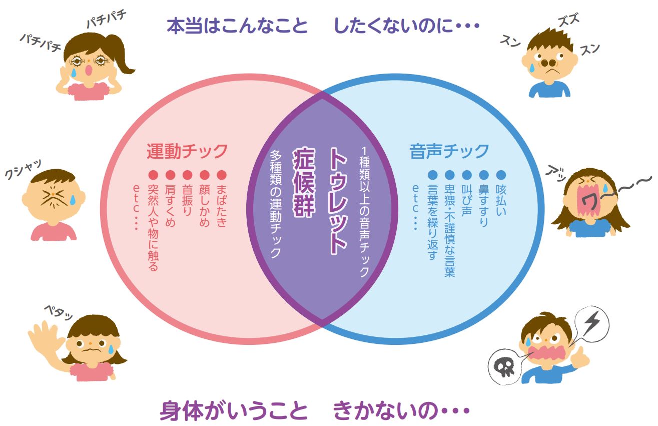 ビリーアイリッシュはトゥレット症候群で発達障害 天才な理由は ネタ取りの翁